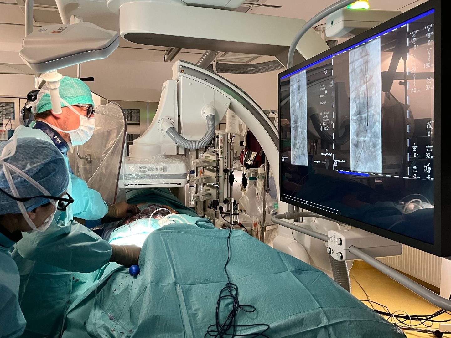 Interventioneller Radiologe in der Angiographie-Suite bei der Durchführung einer TAPE-Behandlung